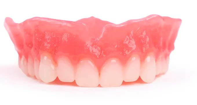 Lucitone upper denture